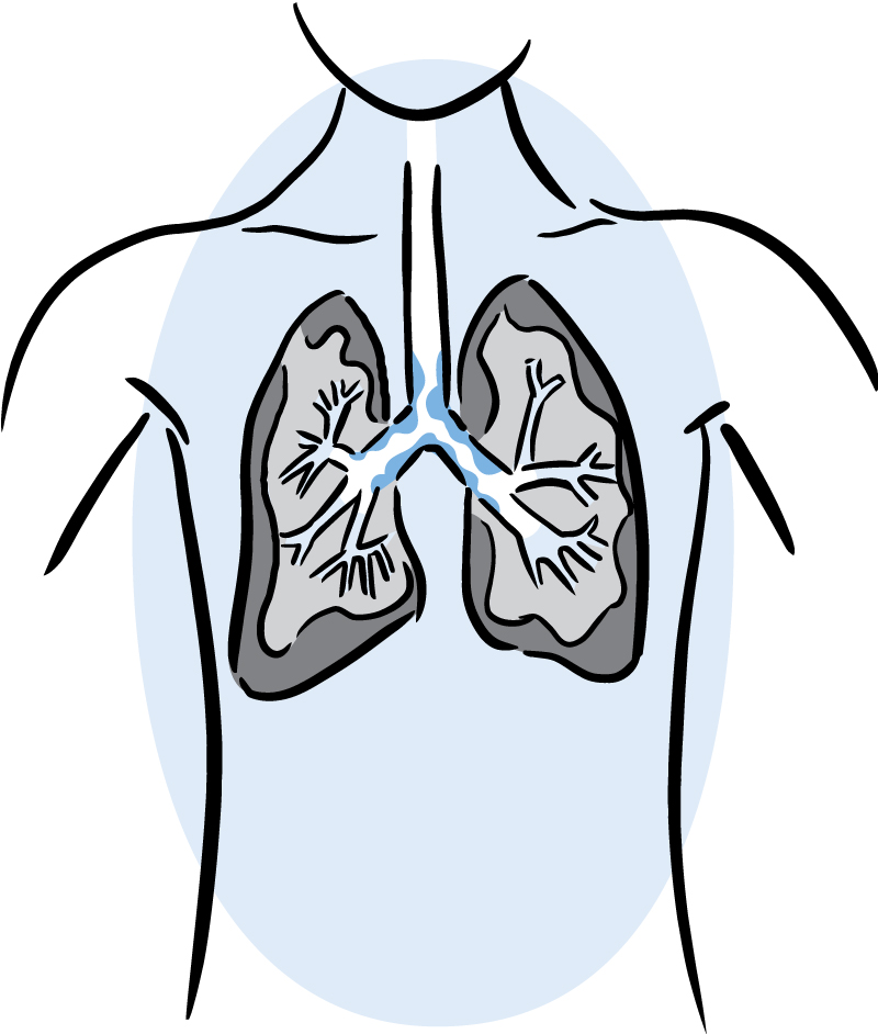 Illustration of lungs with mucus.