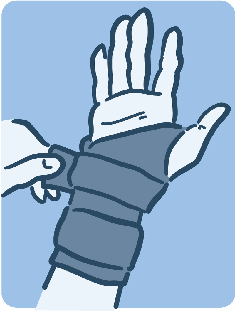 Illustration of a hand brace