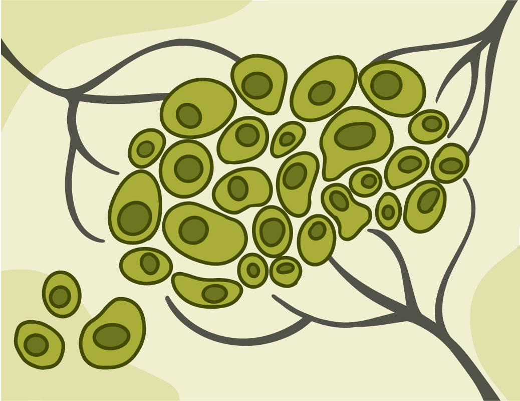 Illustration of cells migrating out of a tumor.